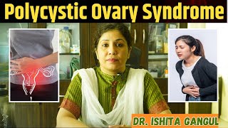 Polycystic Ovary Syndrome in hindi PCOS  Causes Symptoms amp Treatment [upl. by Romeu]