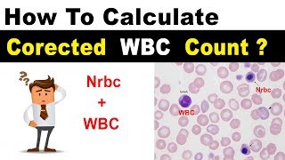 Corrected WBC Count  Clear Explain [upl. by Inajna]