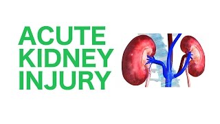 Acute Kidney Injury AKI  USMLE [upl. by Azirb]