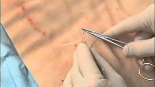 Surgical Knot Tying Onehanded Righty [upl. by Assiluy]