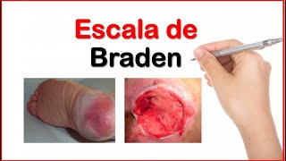 Escala de Braden [upl. by Kara]