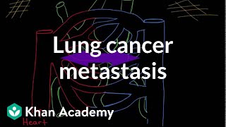 Lobar and Segmental Lung Anatomy on CT [upl. by Severn401]