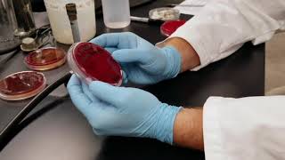 Blood Agar and Hemolysis [upl. by Lobell]