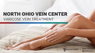 How to treat Varicose Veins and what causes them [upl. by Darrill]