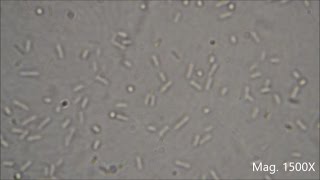 Bacteria under the Microscope E coli and S aureus [upl. by Eiclek]