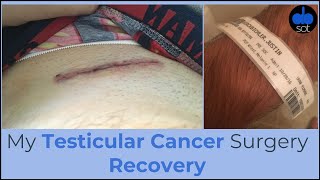 My Testicular Cancer Surgery Recovery [upl. by Charmion70]