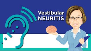 Vestibular Neuritis [upl. by Hankins769]