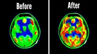 How Your Brain Makes Its Own Electricity [upl. by Hteboj]