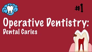 Operative Dentistry  Dental Caries  INBDE ADAT [upl. by Dnomed]