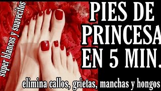 PIES DE PRINCESA en 5 Min ELIMINA callos grietas hongos blanquea e hidrata [upl. by Leimaj]