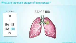 Bone Metastases in CRPC Prognostic for Survival [upl. by Onitnas]