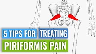 Treatment for Piriformis Pain [upl. by Akemot808]