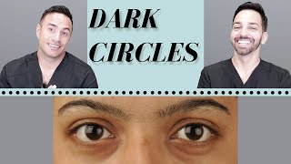 Dark Circles Causes amp Treatments  Dermatologist Perspective [upl. by Lertnom]