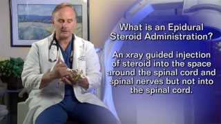 Epidural Steroid InjectionPatient Education Video [upl. by Chantalle]