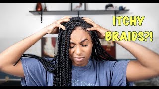 How To Relieve Itchy Scalp  Box Braids [upl. by Topliffe]