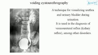 voiding cystourethrography [upl. by Buell]