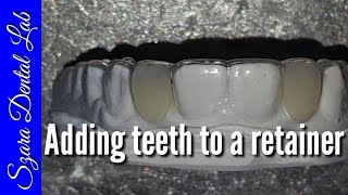 How to add Teeth to Clear Retainer [upl. by Virgel955]