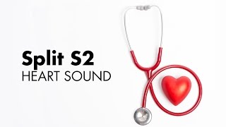 Fixed Split S2  Heart Sounds  MEDZCOOL [upl. by Drandell981]