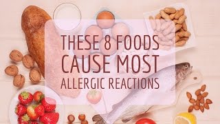 Food Allergy Causes Signs and Symptoms Diagnosis and Treatment [upl. by Rednal]