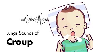 9 Different Cough Types in Kids [upl. by Gnol]