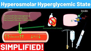 Hyperosmolar Hyperglycemic Nonketotic Syndrome  Panmedicad [upl. by Hofstetter]