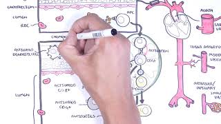 Vasculitis  Causes Symptoms amp Treatment [upl. by Terence104]