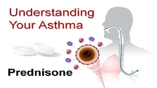 Understanding Your Asthma Part 5 Prednisone [upl. by Adigirb]