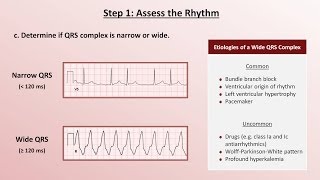 Intro to EKG Interpretation  A Systematic Approach [upl. by Stephani]