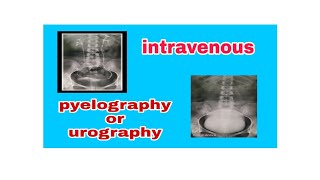 Intravenous Pyelography  Urography IVP  IVU [upl. by Atsocal]