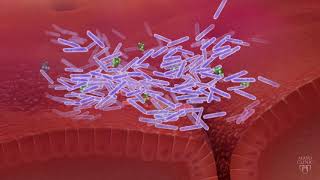 Factors That Impact C difficile Infection Recurrence [upl. by Enaht]