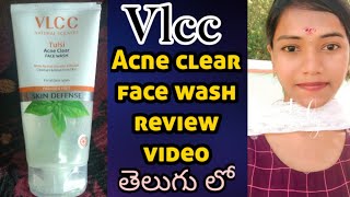 Vlcc tulsi acne clear face wash review in telugu acne clear face wash  acne clear solution video [upl. by Ydnas]