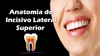 Aula de Anatomia Dental  Anatomia do Incisivo Lateral Superior  Dente 12 e 22 [upl. by Humfrid]