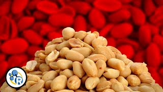 The Truth About Peanut Allergies [upl. by Nazario329]