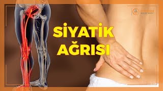 SİYATİK HASTALIĞI [upl. by Drofiar]