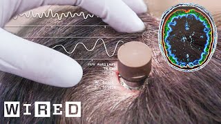 The Science Behind Elon Musk’s Neuralink Brain Chip  WIRED [upl. by Solon]