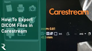 Carestream  How to export DICOM files [upl. by Nawor]