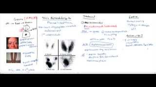 Approach to a Thyroid Nodule  causes investigation and treatment [upl. by Noxid697]