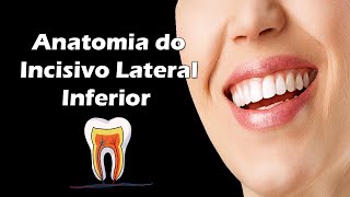 Aula de Anatomia Dental  Anatomia do Incisivo Lateral Inferior  Dente 32 e 42 [upl. by Marco942]