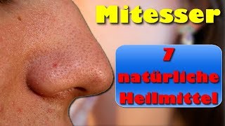 Mitesser – 7 Natürliche Heilmittel gegen Mitesser und Pickel [upl. by Holofernes430]