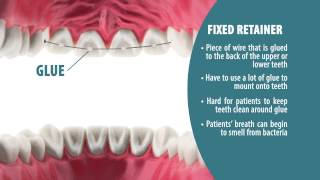 Types of Retainers  Retainer Wear Part 2 [upl. by Rap]