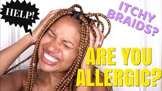 HOW TO RELIEVE ITCHY BRAIDS  SYNTHETIC HAIR ALLERGY [upl. by Nothgierc]