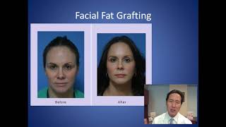 How Do I Add Volume to My Cheeks  Facial Fat Grafting Consultation  Dr Anthony Youn [upl. by Sullivan965]