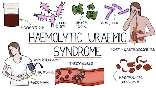 Haemolytic Uraemic Syndrome [upl. by Brainard]