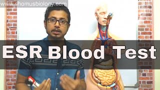 ESR test in Hindi erythrocyte sedimentation rate test [upl. by Norrad781]