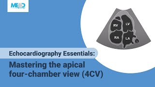 What is an Echocardiogram [upl. by Kristian872]