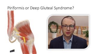 Piriformis Syndrome or Deep Gluteal Syndrome [upl. by Adaj]