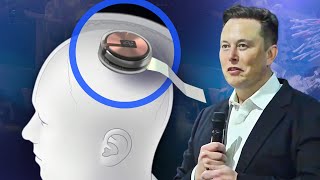 Elon Musks Neuralink brain chip demo explained [upl. by Nerac]