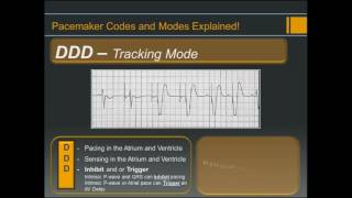 Pacemaker Codes and Modes  Explained [upl. by Atikat]