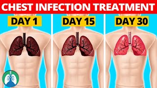 Top 10 Natural Lung Infection Treatments Home Remedies [upl. by Gustavus]