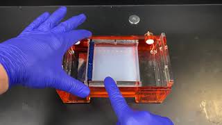 Agarose Gel Electrophoresis [upl. by Yliah]